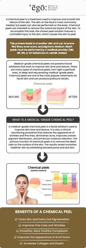 Chemical peels are the best solution to get rid of acne marks, wrinkles, uneven skin, pigmentation, and scars. It removes the top layer and dead skin cells, leaving youthful, baby-like skin. If you are interested in getting a chemical peel, come to Ego Beauty And Wellness. For more information, contact us or schedule an appointment online. We are conveniently located at 1300 Mable Ave Suite C Modesto, CA 95355.